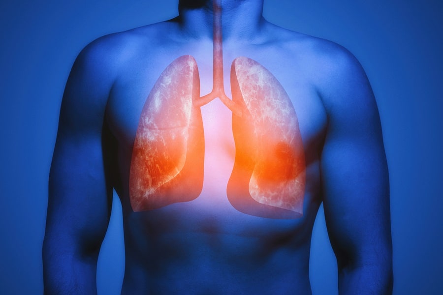 huile de nigelle asthme